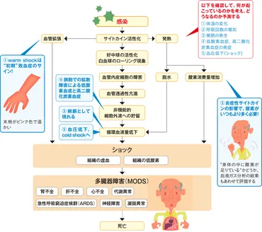 どのように敗血症と気づく？疑ったらどうする？ 