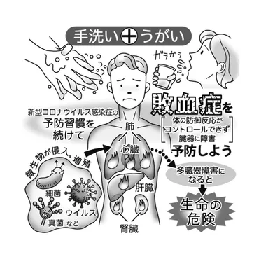 気になる症状 すっきり診断（９９）命脅かす敗血症／感染症の予防が最重要 